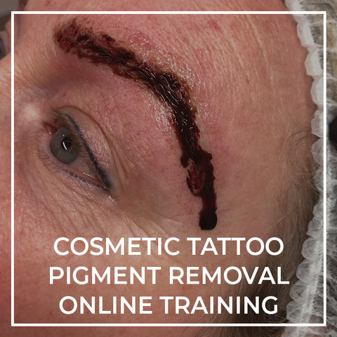 Online Cosmetic Tattoo Pigment Removal Course
